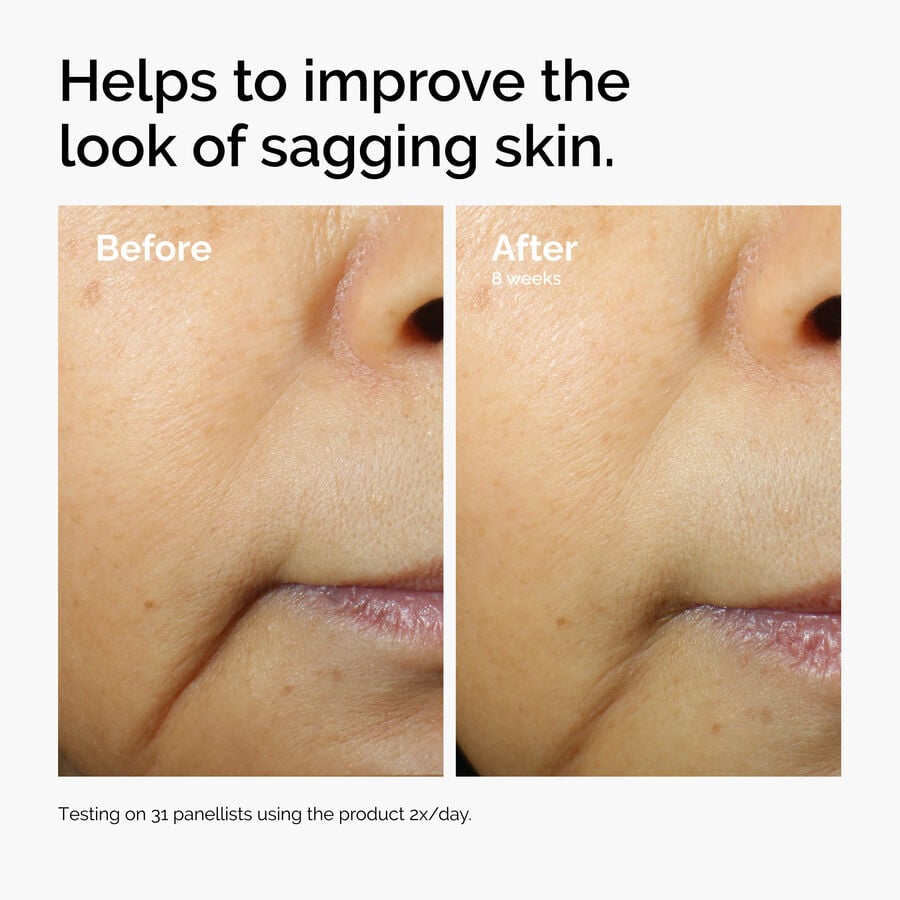 caffeine-3-escin-1-face-serum-p7 ord-caffeine-3pct-escin-1pct-face-serum-before-after-sagging.jpg