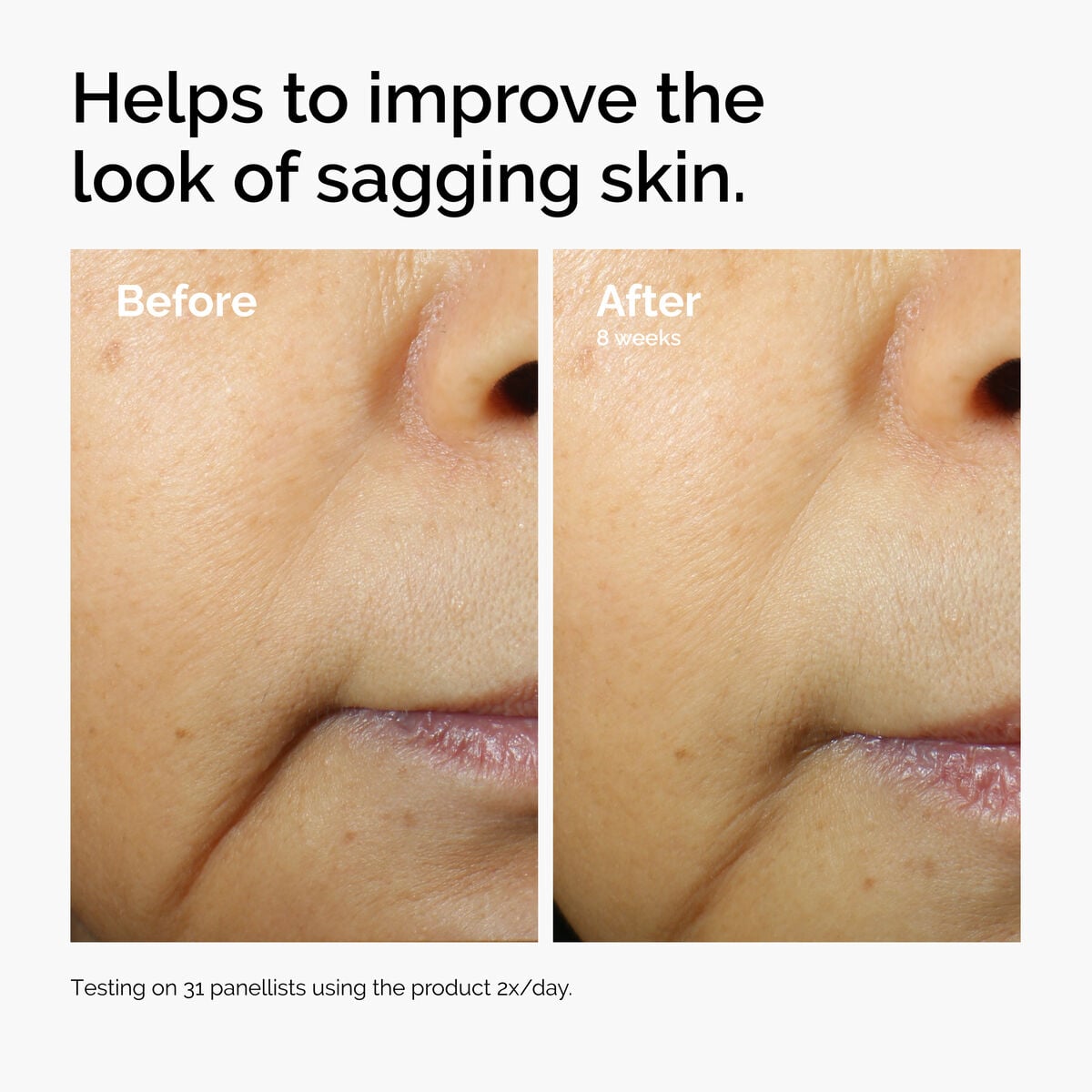 caffeine-3-escin-1-face-serum-p7 ord-caffeine-3pct-escin-1pct-face-serum-before-after-sagging.jpg