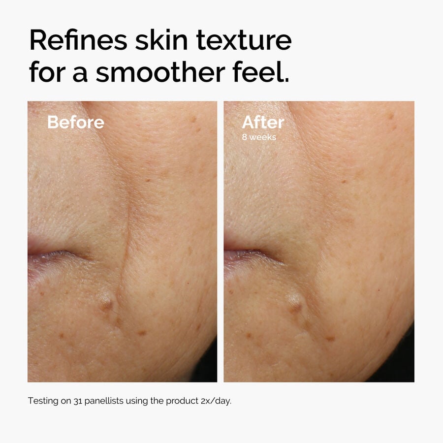 caffeine-3-escin-1-face-serum-p7 ord-caffeine-3pct-escin-1pct-face-serum-before-after-texture.jpg