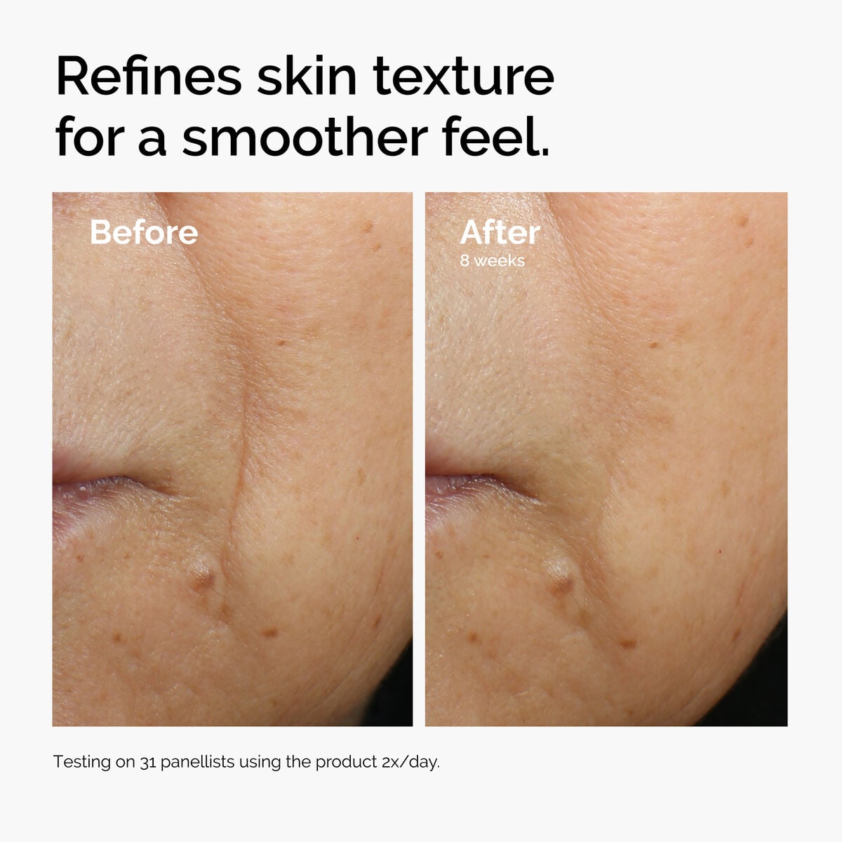 caffeine-3-escin-1-face-serum-p7 ord-caffeine-3pct-escin-1pct-face-serum-before-after-texture.jpg