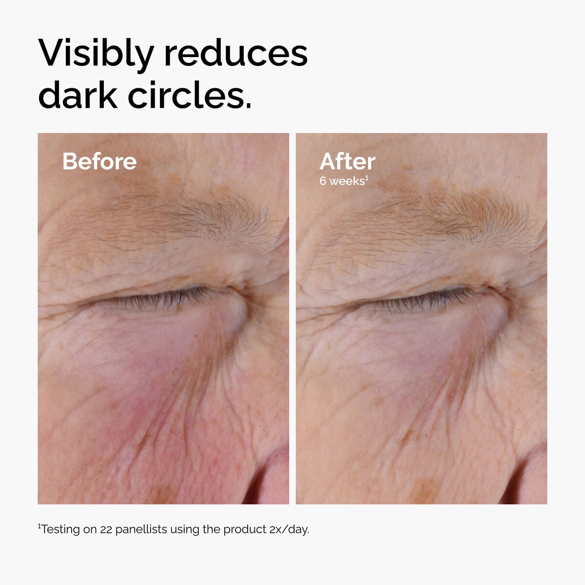 caffeine-solution-5-egcg-eye-serum-n6 ord-caffeine-solution-egcg-dark-circles-before-after.jpg