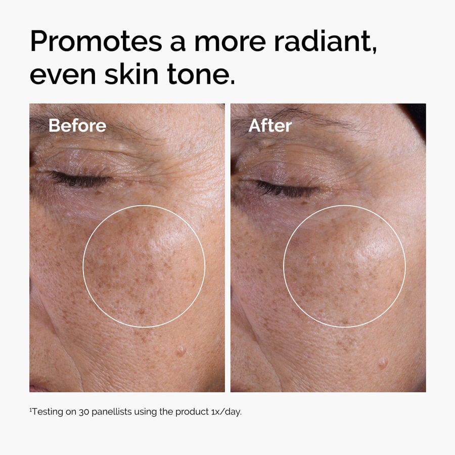 glycolic-acid-7-exfoliating-toner-f3 ord-glycolic-before-after-radiance.jpg