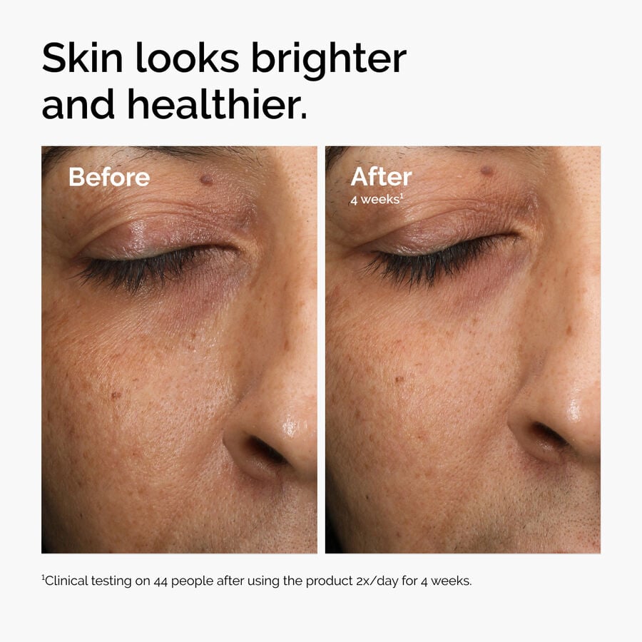 multi-antioxidant-radiance-serum-z7 ord-mars-before-after-healthy.jpg