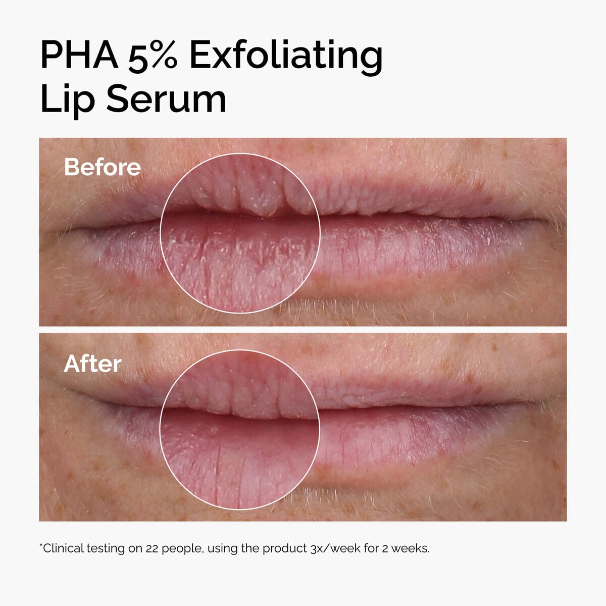 pha-5-exfoliating-lip-serum-m7 ord-pha-5pct-lip-exfoliating-serum-before-after.jpg