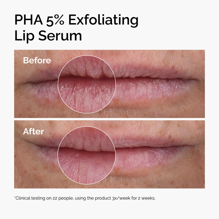 pha-5-exfoliating-lip-serum-m7 ord-pha-5pct-lip-exfoliating-serum-before-after.jpg