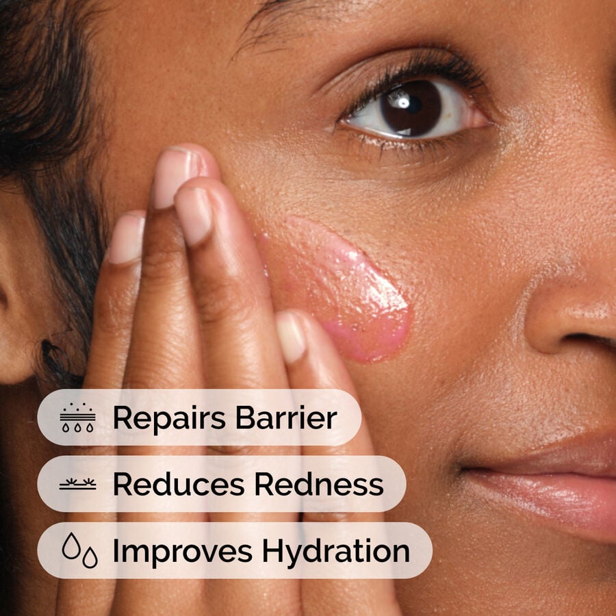 soothing-and-barrier-support-serum-u5 ord-soothing-barrier-support-serum-model-application-with-benefits.jpg